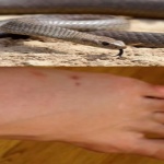Woman's death from snakebite,korba, कोरबा, छग