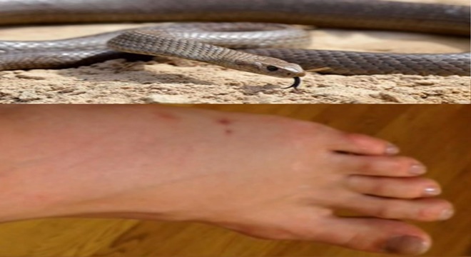 Woman's death from snakebite,korba, कोरबा, छग