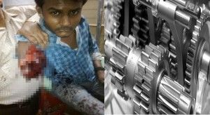 labour glucose factroy in surguja