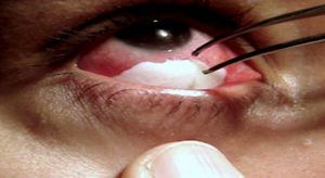 girls-eye-copper-pieces