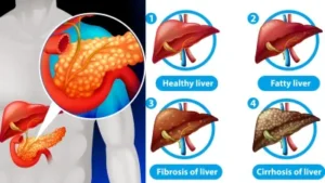 liver-health-02-07-2024-1719889127
