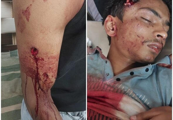 2026-04-25-08-21-05-209